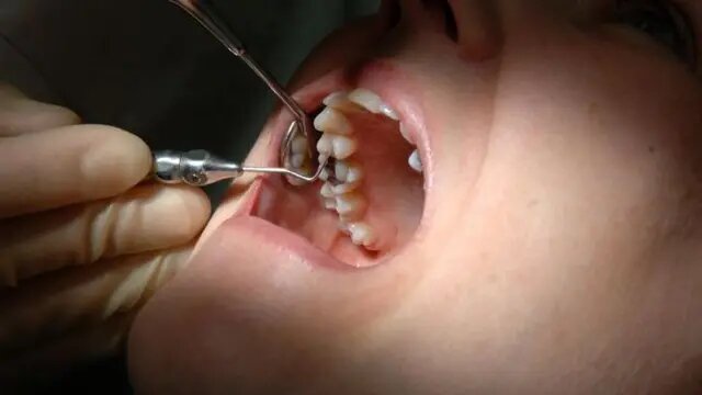وقتی اقتصاد به‌نفع مردم نیست سلامت دندان هم قربانی می‌شود؛ مسئولان برای سلامت ارزش قائل نیستند/ تلویزیون چیزی جز چیپس و پفک تبلیغ می‌کند؟