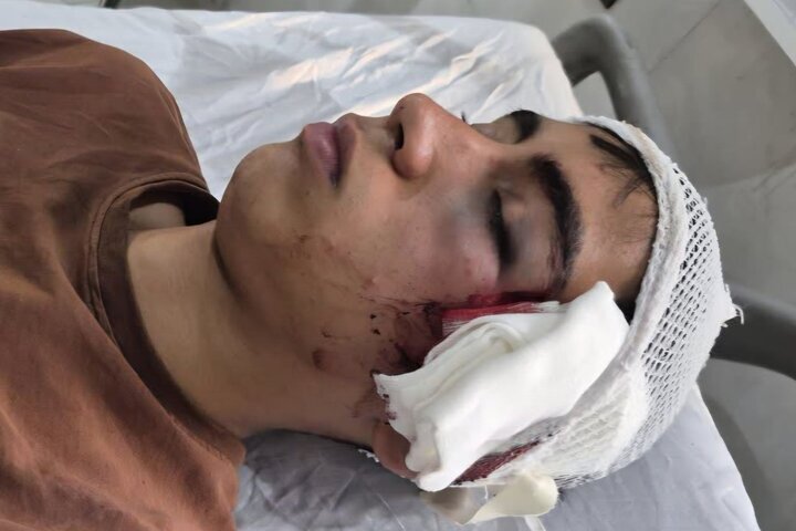 ضرب‌وشتم دانش‌آموز با دسته صندلی / روایت پدر از خشونت علیه فرزندش در دبیرستان دهبکری بم / آموزش‌وپرورش وعده پیگیری داد + عکس دلخراش